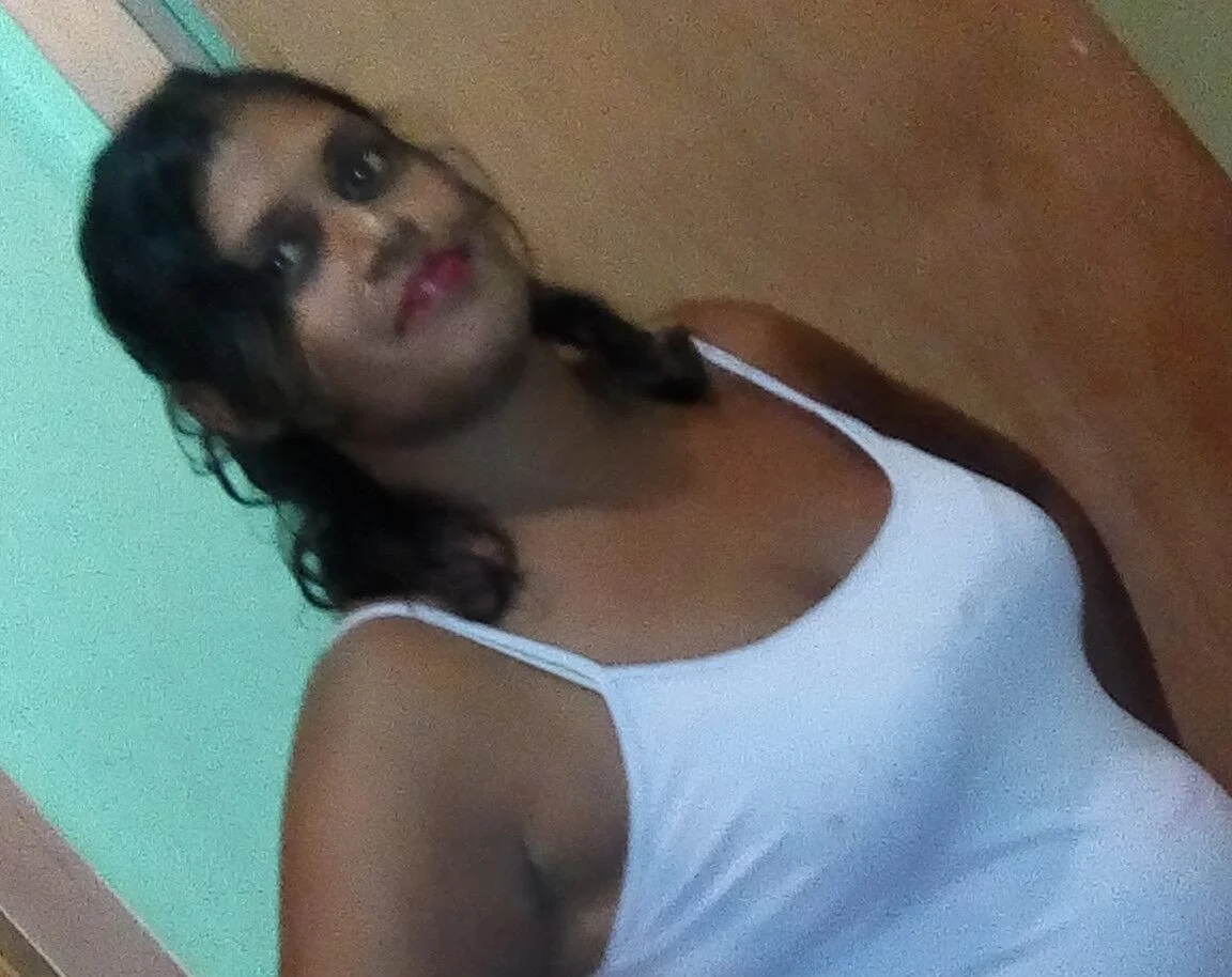 Claxton Bay Woman Dies from Injuries Sustained in Suspected Gas Explosion